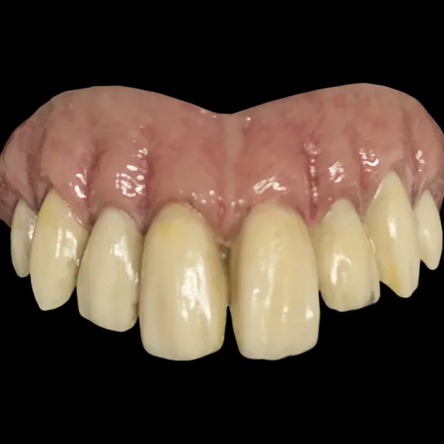 Bitemares Horror Teeth - Goofy Teeth